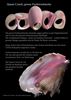 Conch, Queenconch, Fechterschnecke, strombusgigas,